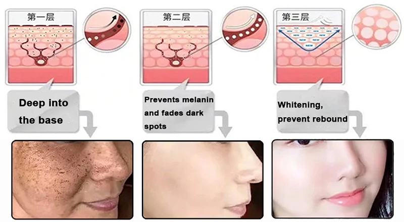 phloretin powder Whitening